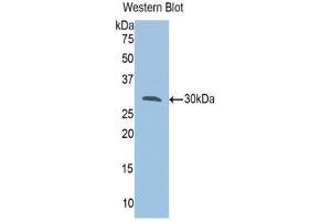 Image no. 1 for anti-VAMP (Vesicle-Associated Membrane Protein)-Associated Protein A, 33kDa (VAPA) (AA 1-249) antibody (ABIN1078660)