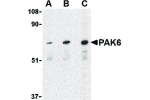 PAK6 抗体  (Internal Region)