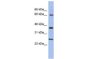 Image no. 1 for anti-HORMA Domain Containing 2 (HORMAD2) (Middle Region) antibody (ABIN2785191)