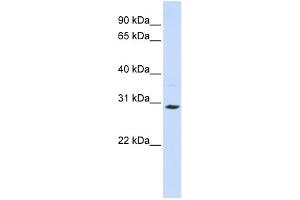 Image no. 1 for anti-Solute Carrier Family 25 (Carnitine/acylcarnitine Translocase), Member 20 (SLC25A20) (C-Term) antibody (ABIN2781540)