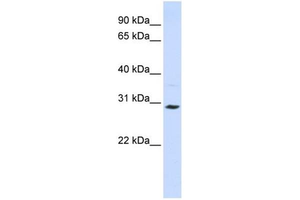 anti-Solute Carrier Family 25 (Carnitine/acylcarnitine Translocase), Member 20 (SLC25A20) (C-Term) antibody