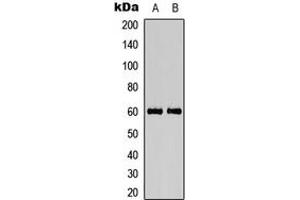 Image no. 1 for anti-Calcium/calmodulin-Dependent Protein Kinase IV (CAMK4) (Center), (pThr200) antibody (KLH) (ABIN2972825)