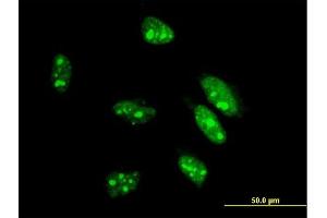 Image no. 1 for anti-Caudal Type Homeobox 1 (CDX1) (AA 126-215) antibody (ABIN514322)