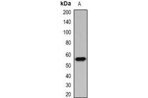 Image no. 1 for anti-Interferon-Induced Protein with Tetratricopeptide Repeats 3 (IFIT3) antibody (ABIN3198143)