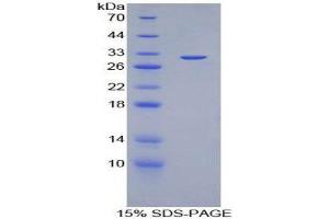 Image no. 1 for Inhibitor of KB Kinase beta Interacting Protein (IKbIP) (AA 80-315) protein (His tag) (ABIN1879413)