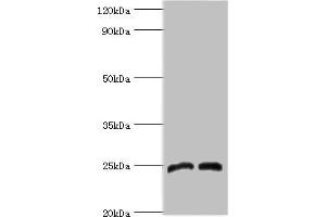 DKK4 Antikörper  (AA 19-224)