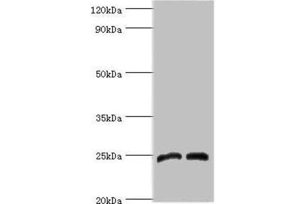 DKK4 Antikörper  (AA 19-224)
