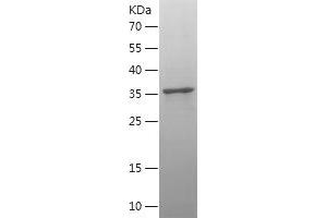 COX2 Protein (AA 104-209) (IF2DI tag)