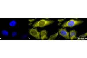 Image no. 1 for anti-T-Complex 1 (TCP1) (C-Term) antibody (HRP) (ABIN2485922)