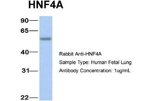 Image no. 4 for anti-Hepatocyte Nuclear Factor 4, alpha (HNF4A) (N-Term) antibody (ABIN2777514)