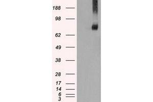 Image no. 1 for anti-Fermitin Family Member 2 (FERMT2) antibody (ABIN2721012)