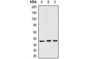 Image no. 2 for anti-Inhibitor of Growth Family, Member 3 (ING3) antibody (ABIN3198160)