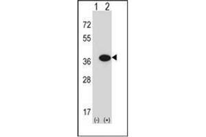 Image no. 1 for anti-Guanosine Monophosphate Reductase (GMPR) (AA 237-267), (C-Term) antibody (ABIN952562)