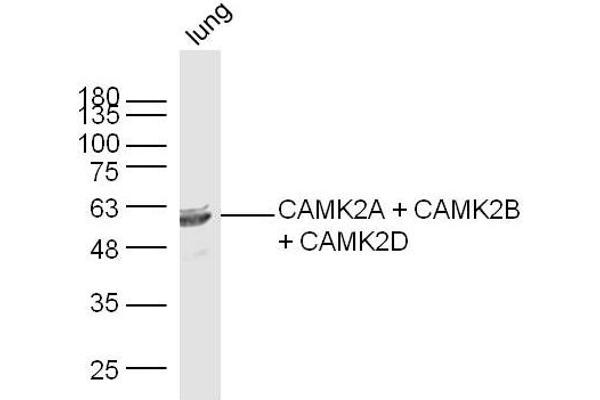 CAMK2B Antikörper  (AA 1-100)