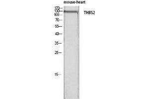 Image no. 2 for anti-Thrombospondin 2 (THBS2) antibody (ABIN3188092)