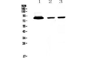 Image no. 4 for anti-Lactotransferrin (LTF) (AA 529-710) antibody (ABIN5693189)