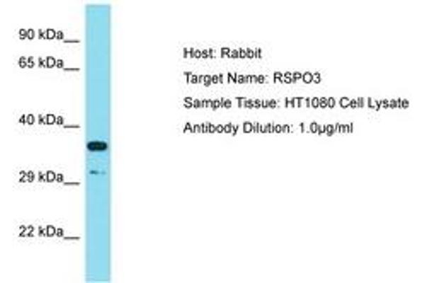 R-Spondin 3 Antikörper  (AA 202-251)
