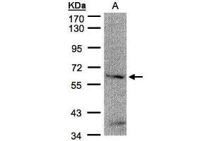 Image no. 3 for anti-Fanconi Anemia Complementation Group G (FANCG) (Center) antibody (ABIN2857083)