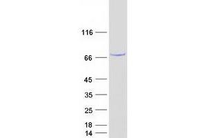 Image no. 1 for Methyltransferase Like 16 (METTL16) protein (Myc-DYKDDDDK Tag) (ABIN2725882)