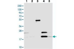 Image no. 2 for anti-Elongator Acetyltransferase Complex Subunit 6 (ELP6) antibody (ABIN5573380)