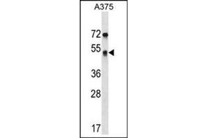 Image no. 1 for anti-Septin 11 (SEPT11) (AA 352-382), (Middle Region) antibody (ABIN954725)