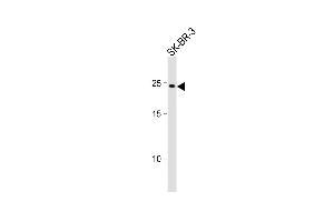 Anti-RAB32 Antibody (N-term) at 1:1000 dilution + SK-BR-3 whole cell lysate.