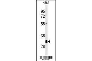 Image no. 1 for anti-Potassium Channel Tetramerisation Domain Containing 7 (KCTD7) (AA 95-123) antibody (ABIN651239)
