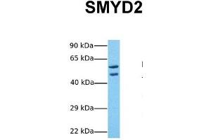 Image no. 3 for anti-SET and MYND Domain Containing 2a (SMYD2A) (Middle Region) antibody (ABIN2784266)