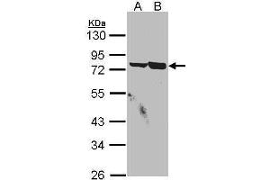 Image no. 1 for anti-Synovial Sarcoma, X Breakpoint 2 Interacting Protein (SSX2IP) (C-Term) antibody (ABIN2855933)