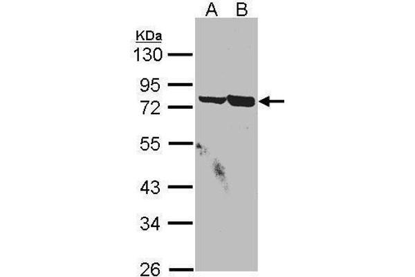 anti-Synovial Sarcoma, X Breakpoint 2 Interacting Protein (SSX2IP) (C-Term) antibody