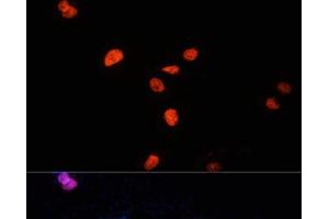 Immunofluorescence analysis of U-2 OS cells using KDM3A Polyclonal Antibody at dilution of 1:100 (40x lens).