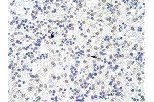 Image no. 1 for anti-Squamous Cell Carcinoma Antigen Recognized By T Cells 3 (SART3) (N-Term) antibody (ABIN203084)