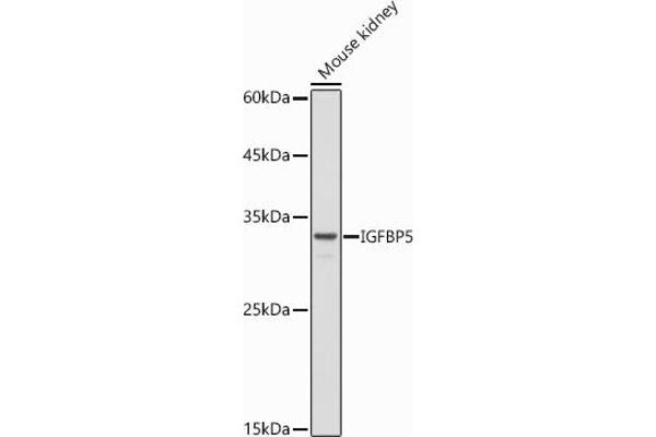 IGFBP5 antibody  (AA 68-167)