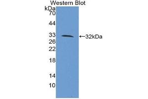 Image no. 1 for anti-Killer Cell Immunoglobulin-Like Receptor, Two Domains, Short Cytoplasmic Tail, 4 (KIR2DS4) (AA 22-302) antibody (ABIN1859540)