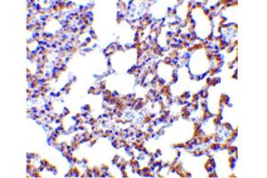 Image no. 1 for anti-SKI-Like Oncogene (SKIL) (N-Term) antibody (ABIN6656781)