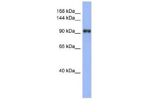 Image no. 1 for anti-La Ribonucleoprotein Domain Family, Member 1 (LARP1) (N-Term) antibody (ABIN2776607)