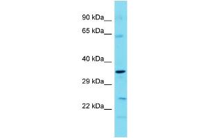 Image no. 1 for anti-TBC1 Domain Family, Member 7 (TBC1D7) (C-Term) antibody (ABIN2786978)