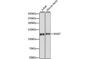 Image no. 1 for anti-Smg-7 Homolog, Nonsense Mediated mRNA Decay Factor (SMG7) antibody (ABIN6568670)