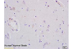 Image no. 2 for anti-Proliferating Cell Nuclear Antigen (PCNA) (AA 151-261) antibody (ABIN676583)