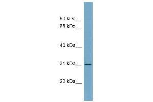 Image no. 1 for anti-Fibrinogen-Like 1 (FGL1) (Middle Region) antibody (ABIN633938)