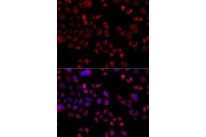 Image no. 2 for anti-Solute Carrier Family 22 (Organic Cation Transporter), Member 11 (SLC22A11) antibody (ABIN6147884)