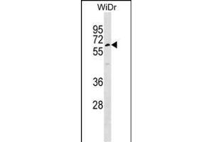 TULP1 Antibody (Center) (ABIN1537977 and ABIN2848730) western blot analysis in WiDr cell line lysates (35 μg/lane).