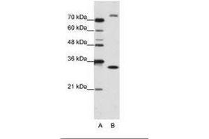 Image no. 1 for anti-Exosome Component 2 (EXOSC2) (N-Term) antibody (ABIN202179)