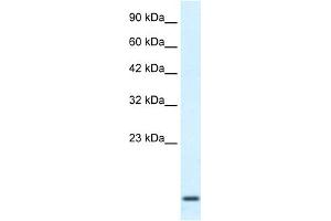 Image no. 1 for anti-Homeobox A1 (HOXA1) (Middle Region) antibody (ABIN2776013)