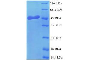 Image no. 1 for Osteoglycin (OGN) (AA 21-298) protein (His tag) (ABIN5710041)