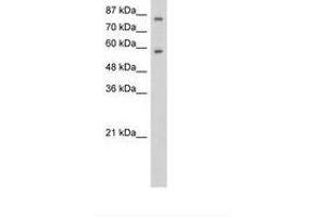 Image no. 1 for anti-Zinc Finger Protein 777 (ZNF777) (C-Term) antibody (ABIN6736254)