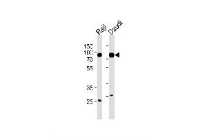 Image no. 2 for anti-Hematopoietic Cell-Specific Lyn Substrate 1 (HCLS1) antibody (ABIN1944806)