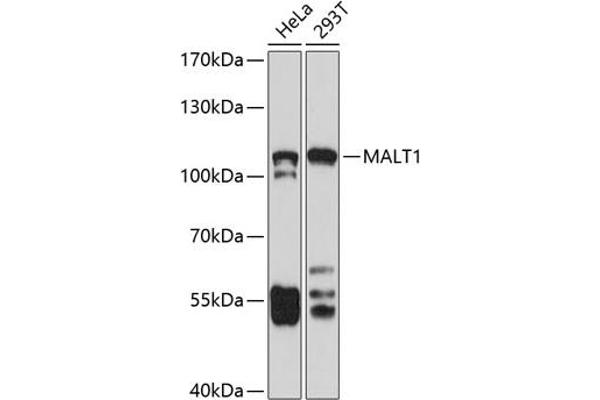 MALT1 抗体  (AA 125-450)