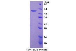 Image no. 1 for Keratin 18 (KRT18) (AA 72-380) protein (His tag) (ABIN1878730)