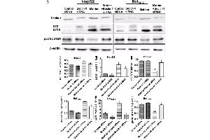 Image no. 7 for anti-Sequestosome 1 (SQSTM1) (AA 51-150) antibody (ABIN682153)
